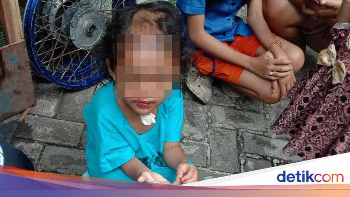 Heartbreaking Fate of Toddler Abused and Head-Shaved by Uncle and Aunt in Surabaya