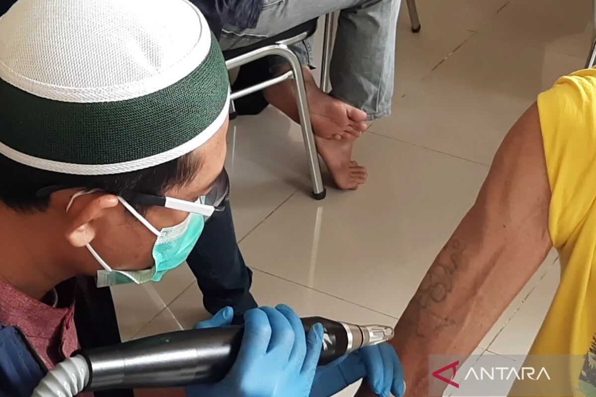 Ensure Good Health Before Undergoing Tattoo Removal, Jakarta Zakat Agency Advises