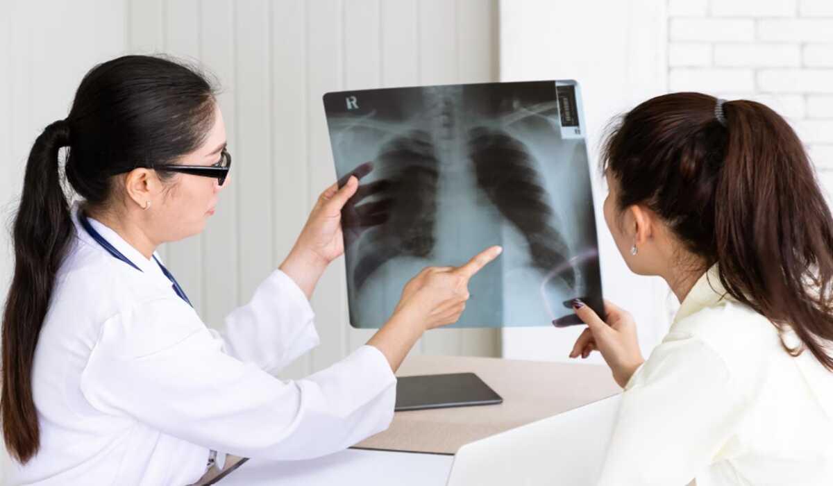 Lung Cancer Trends in Indonesia: Younger Patients, Importance of Early Detection