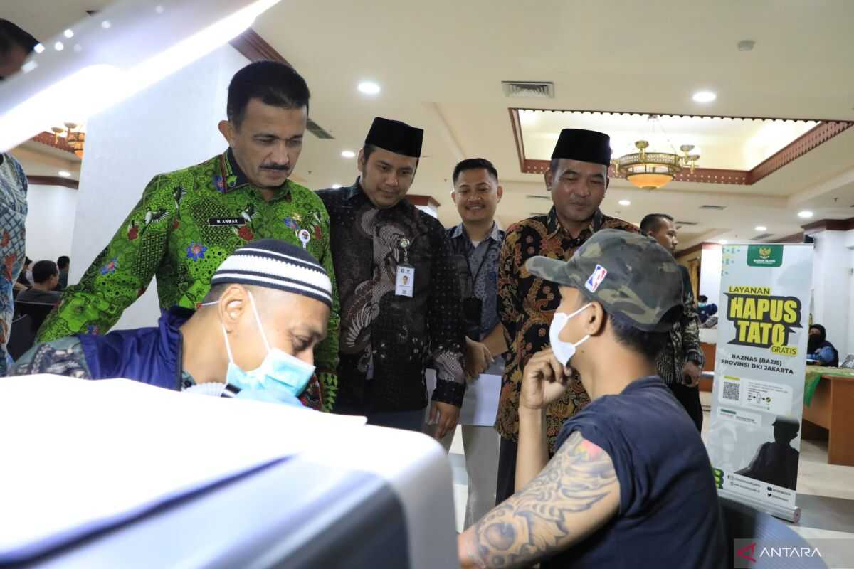 Tattoo Removal in South Jakarta Provides Opportunity for Self-Improvement During Ramadan