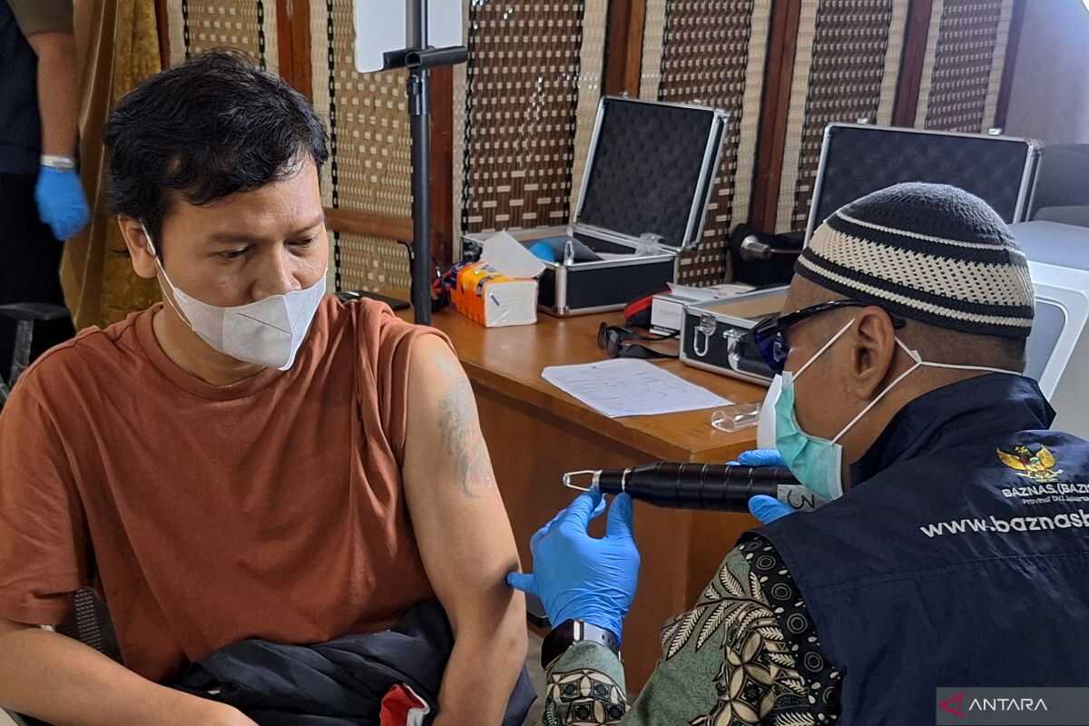 Baznas South Jakarta Provides 100 Places for Free Tattoo Removal