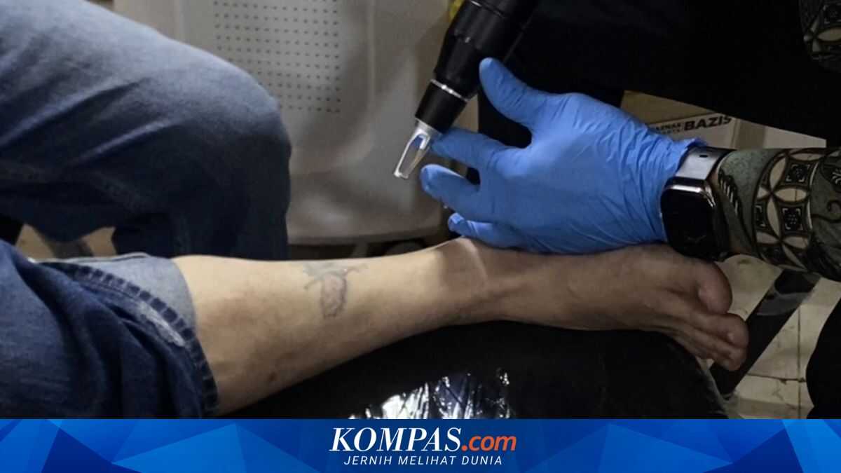 Ikhsan's Story: Erasing a 'Gang' Tattoo from the 80s That Lasted 30 Years