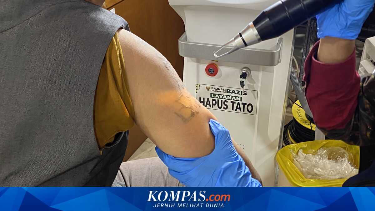 A 60-Year-Old Mother Steadfastly Supports Her Son in Undergoing Free Tattoo Removal by Baznas