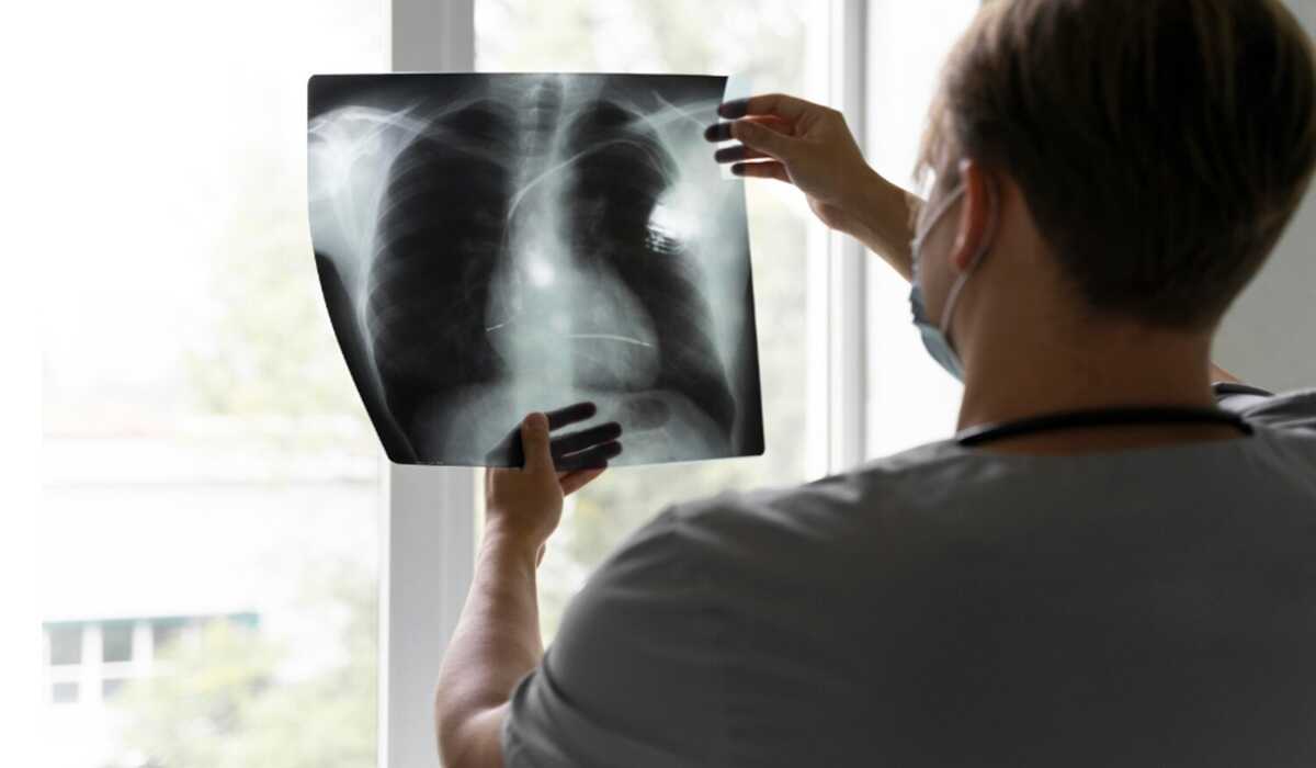 Lung Cancer: A Serious Threat Lurking Among Non-Smokers of Working Age