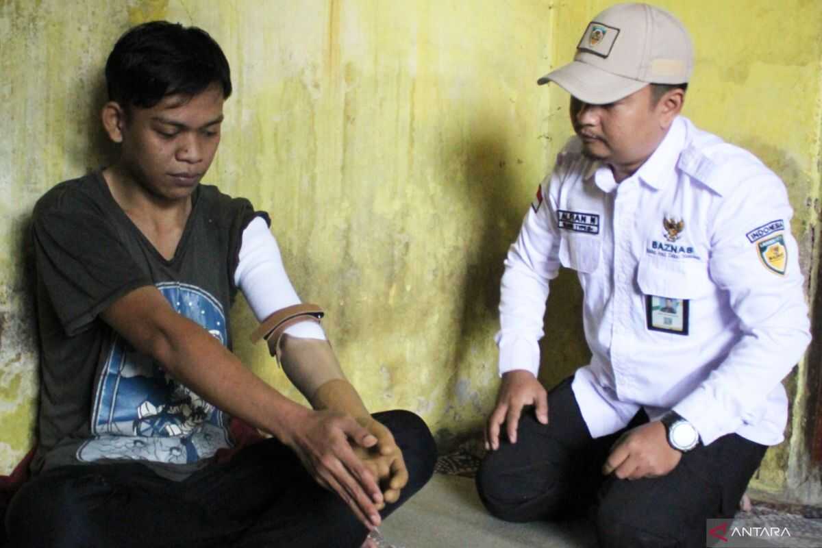 Baznas provides prosthetic arm for people with disabilities in Bogor