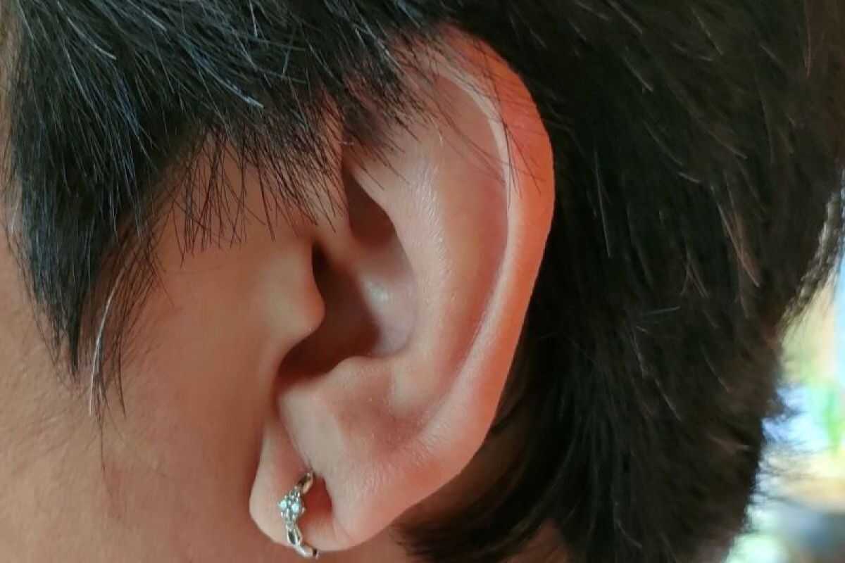 Doctor: A perforated eardrum should be treated with surgery