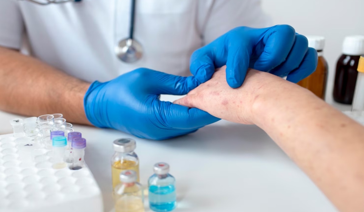 Protecting Children from Measles Fatality: Vaccination as the Key Strategy