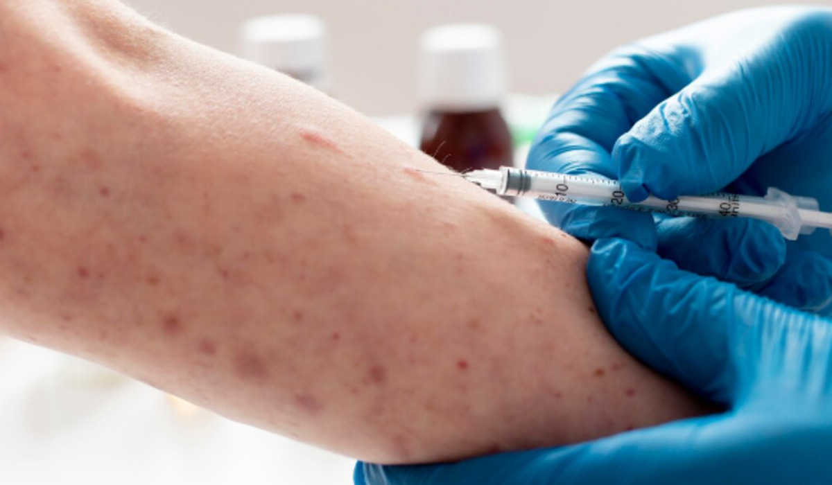 187 Suspects, 2 Confirmed: Makassar Prepares Mass Immunisation Amid Measles Outbreak Alert