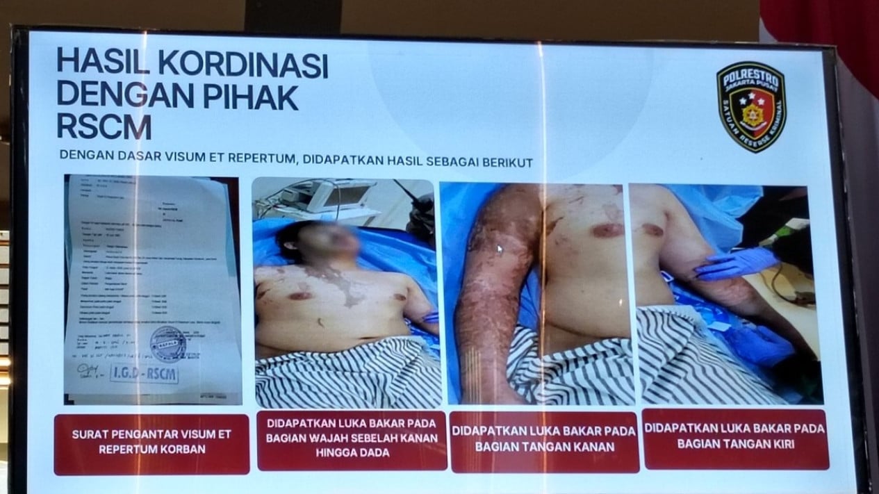 RSCM Discloses Medical Condition of KontraS Activist Andrie Yunus