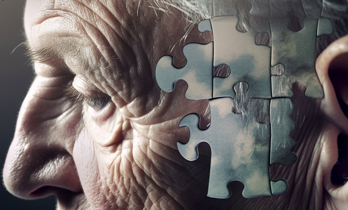 The Secret Behind Lecanemab: How This Alzheimer's Drug Destroys Brain Plaque