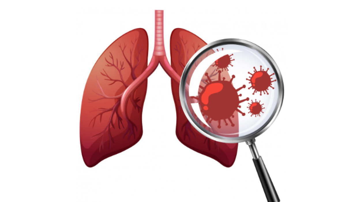 Viral Herbal Remedy to Prevent Tuberculosis, Expert: Misleading Information