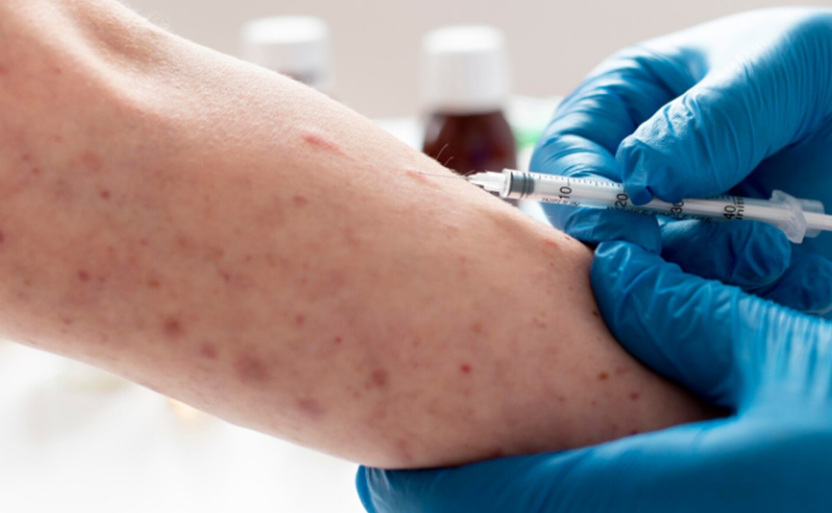 Rise in Measles Cases, Partly Caused by Declining Immunity Post-Pandemic