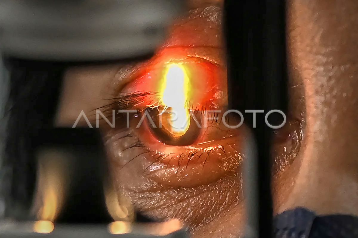 West Jakarta City Government to Hold Free Cataract Surgery Operation