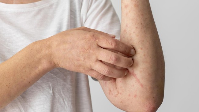 Health Ministry Reveals Timeline of Doctor's Death from Measles Infection While on Duty