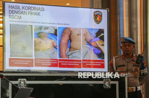 Latest Condition of Andrie Yunus from Kontras: At Risk of Permanent Eye Disability Due to Acid Leakage