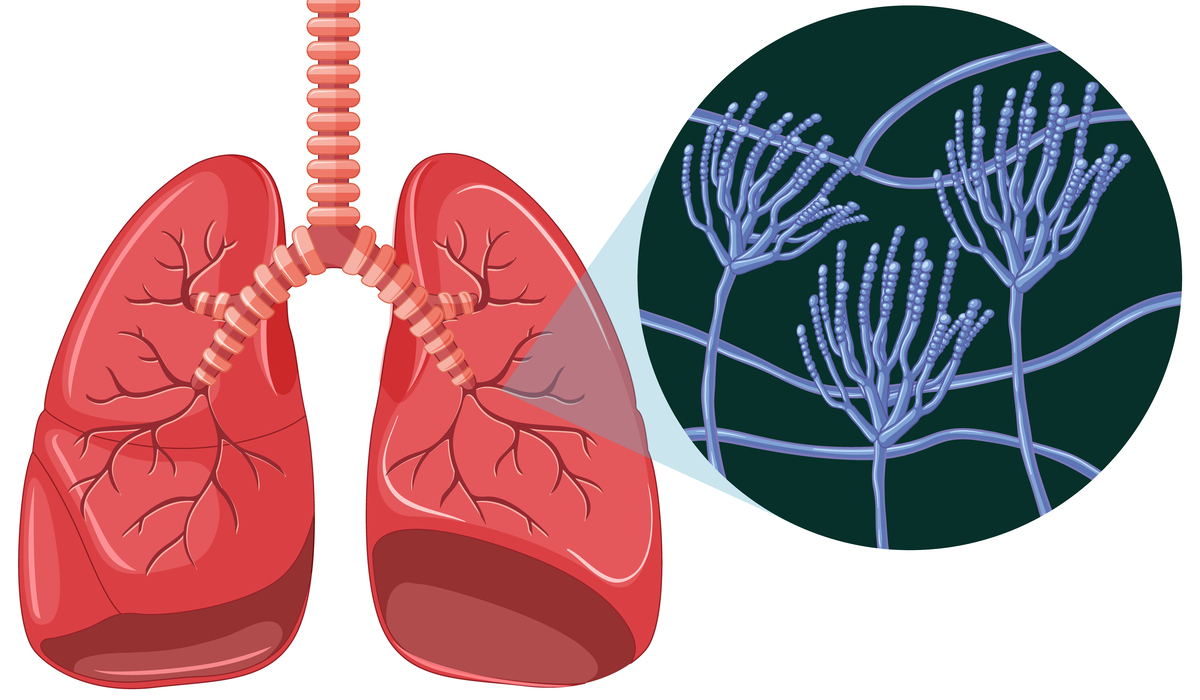 Village Fund Usage for TB Control Must Be on Target