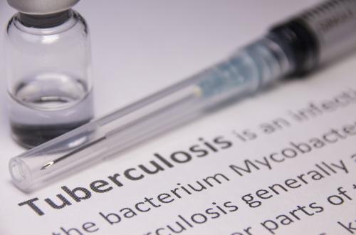 TB in Papua is Alarming, Cases Continue to Increase Until 2026