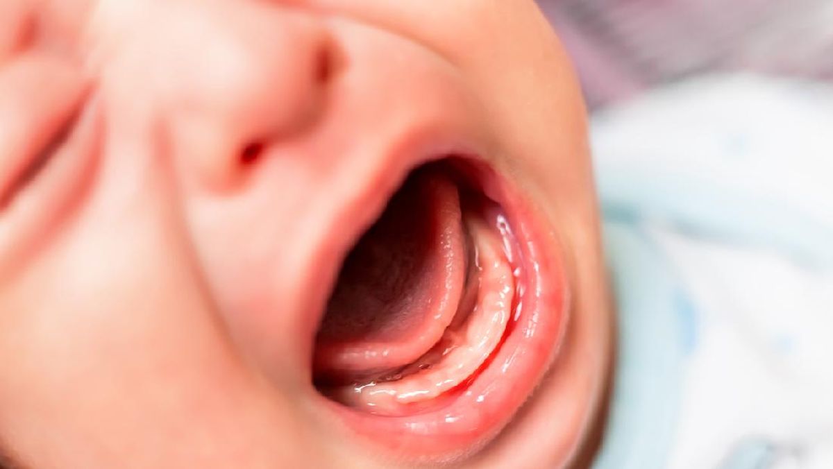 Health Department: Victims of Little Aresha Daycare Suffer Growth Disorders