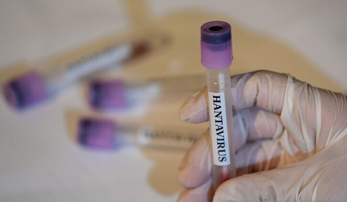 Belarus Reports 50 Cases of Hantavirus per Year, Warns of HFRS Symptoms