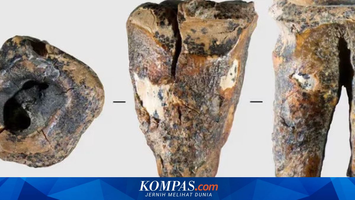 Neanderthals Performed Dental Drilling Without Anaesthetic