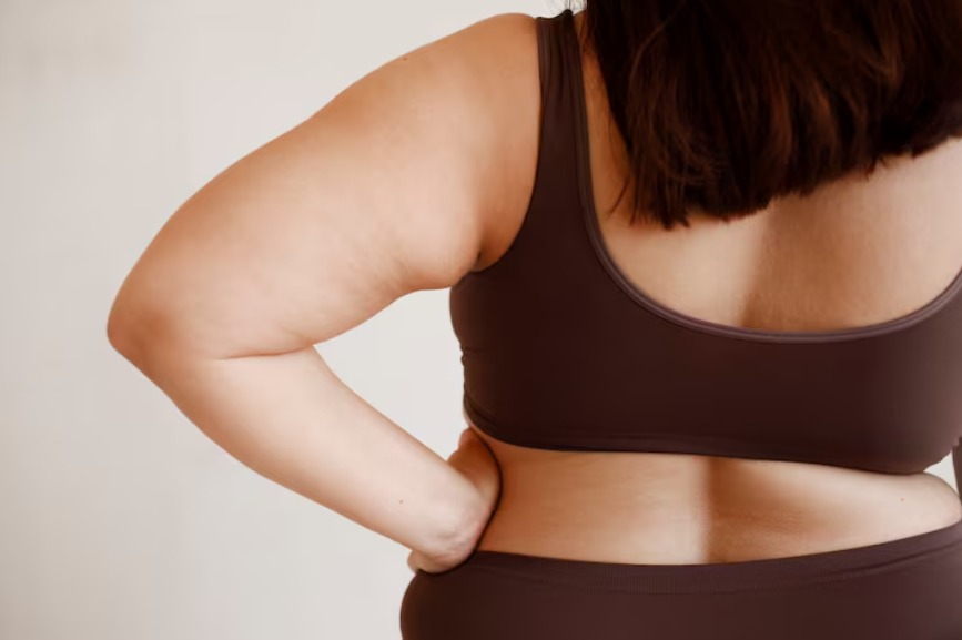 Semaglutide Obesity Therapy Linked to Reduced Migraine Risk in Women