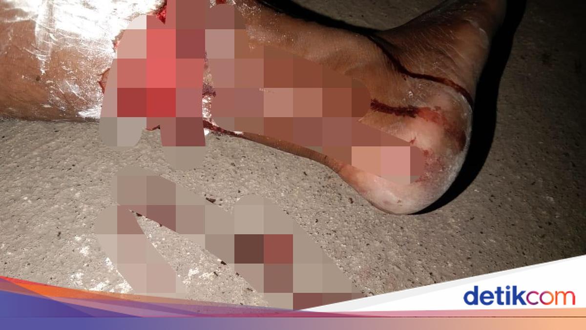 Dog Suspected of Rabies Bites Five Residents of Oelfatu Village, Kupang
