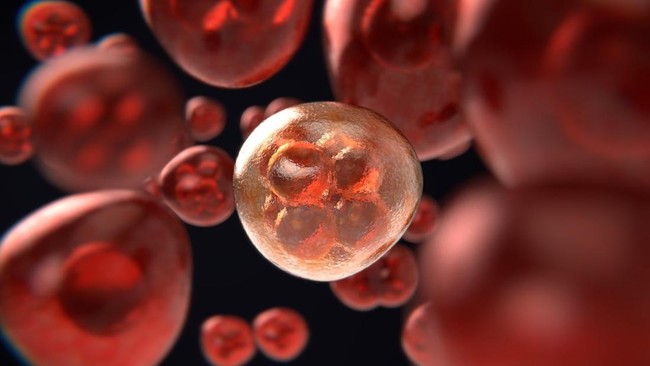 Common Habits of Indonesians Could Trigger Cancer, Avoid Them Now