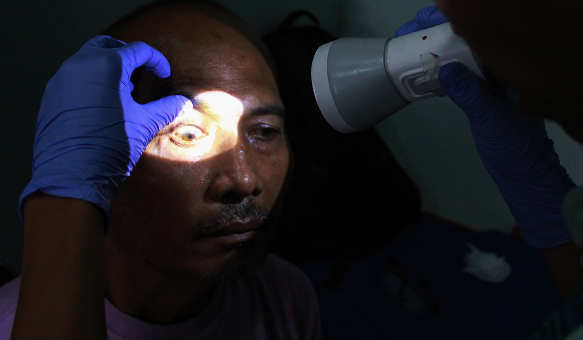 Beware of Cataracts: Doctor Says Symptoms Are Often Unnoticed by Patients