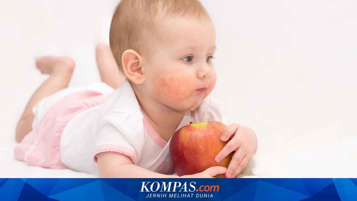 Three Common Mistakes in Caring for a Child's Eczema That Are Often Overlooked