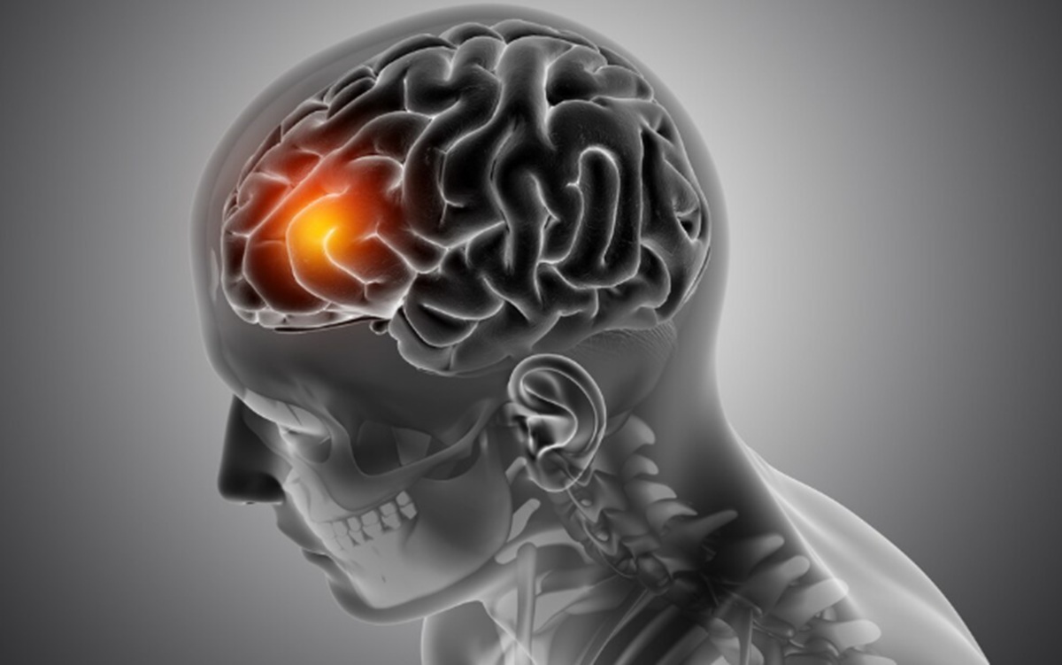 Normal Vitamin B12 Levels Are Not Necessarily Sufficient to Protect the Aging Brain