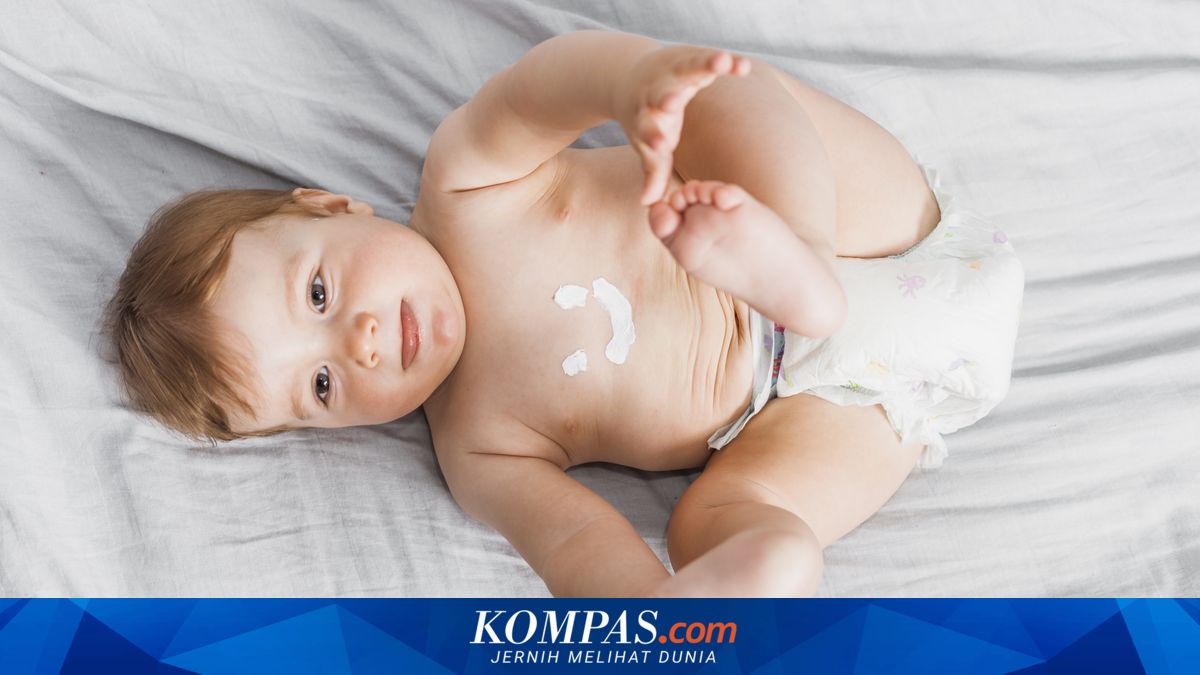 Dangers of Long-Term Corticosteroid Cream Use for Children's Eczema