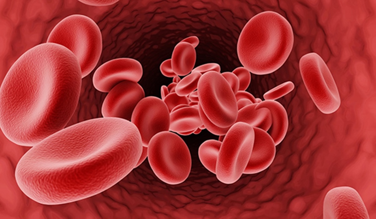 Thalasemia Patients Prohibited from Taking Iron Supplements – Why