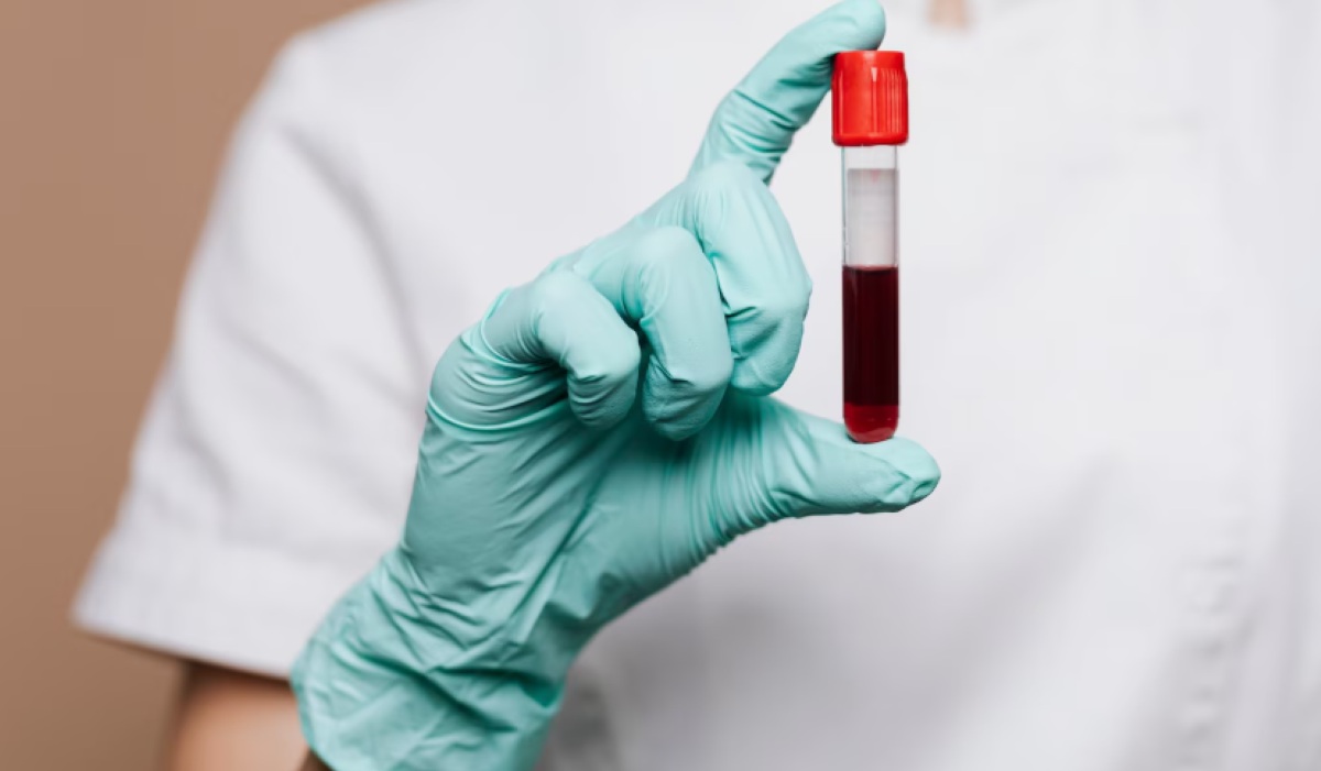 New Study: Blood Biological Age Can Predict Dementia Risk