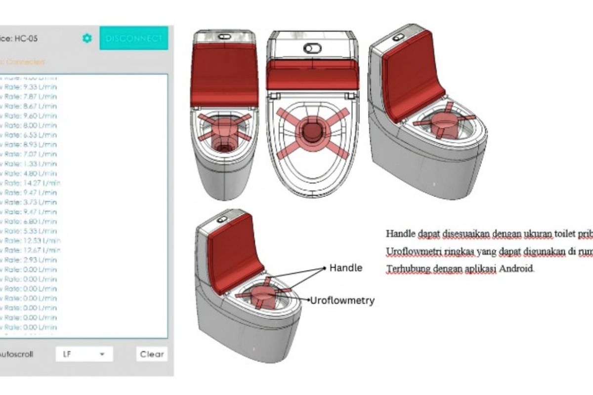 UI develops wireless home uroflowmetry system for urinary disorder assessment