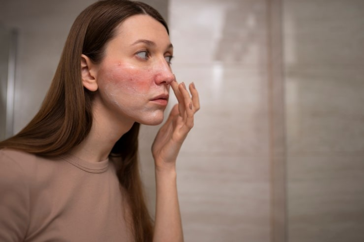 Lupus: Causes, Symptoms, and Risk Factors to Be Aware Of