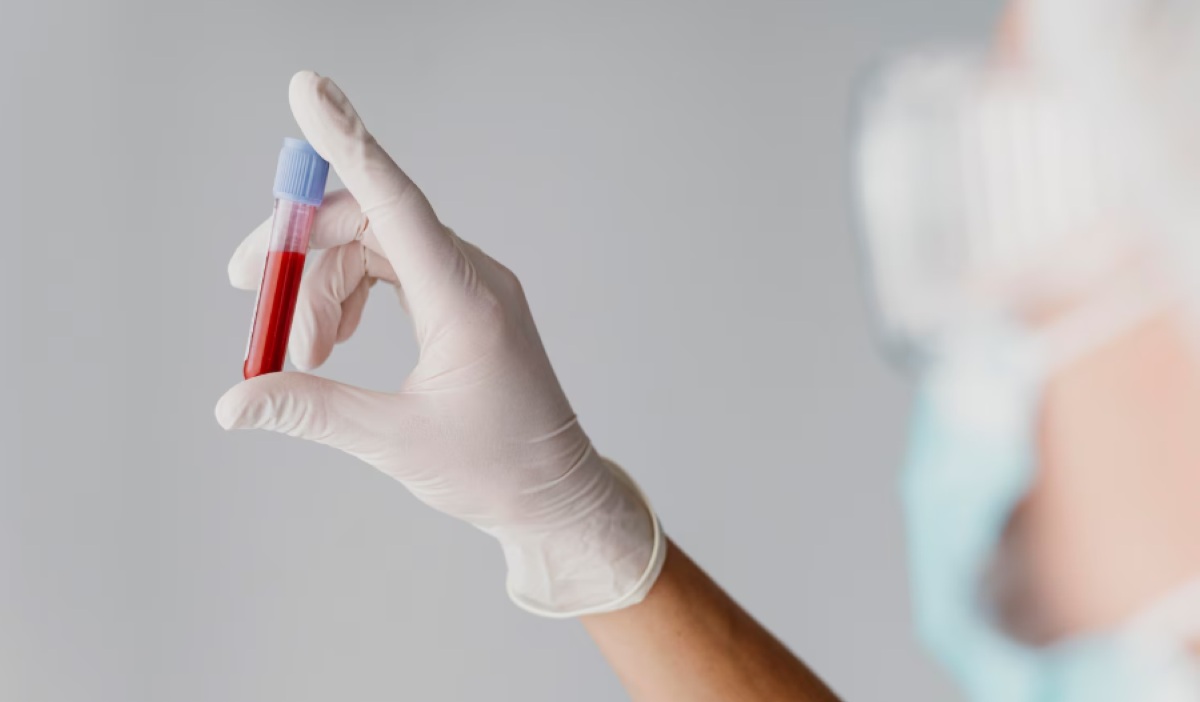 American Cancer Society adds blood test to colorectal cancer screening guidelines