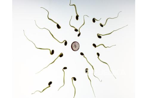 Doctor Explains Causes of Infertility in Men and Women