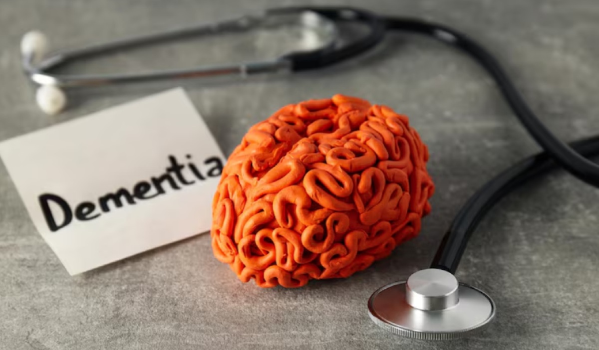 Eight Best Foods for Brain Health and Dementia Prevention