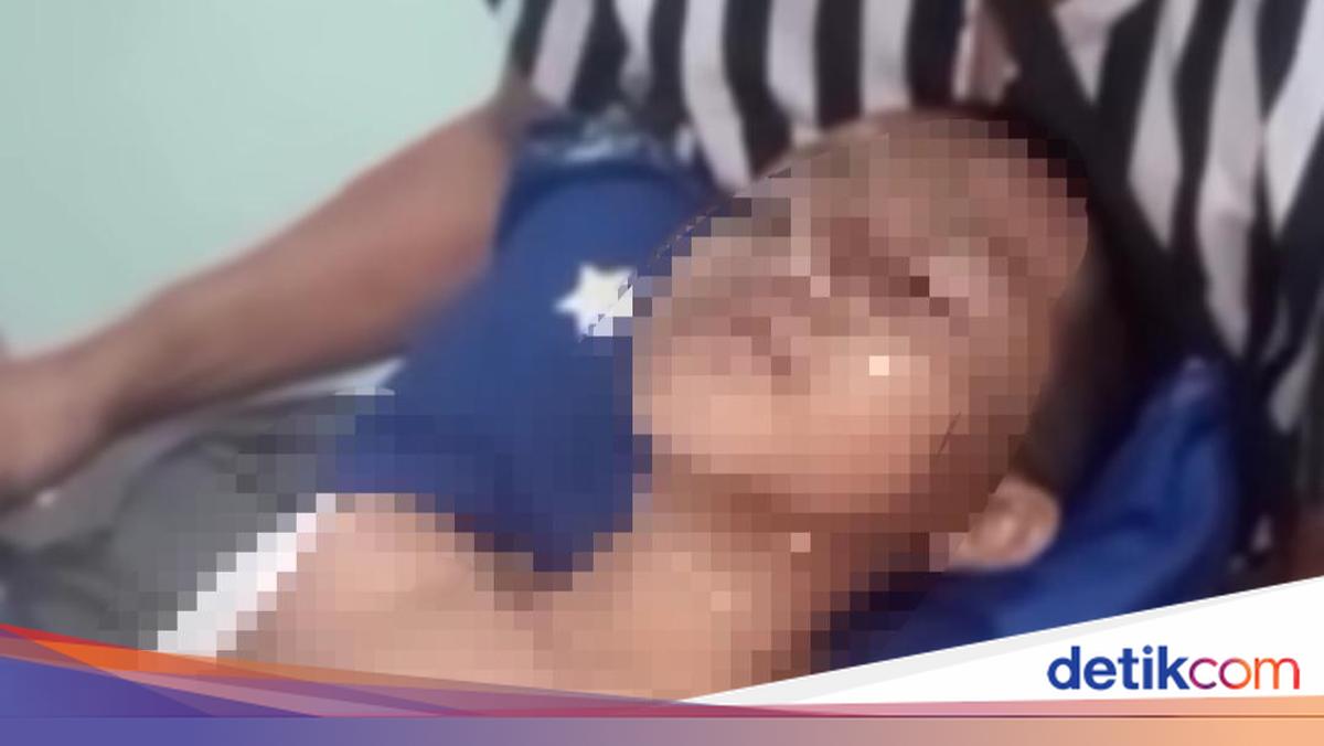 Brutal Attack: Three Students in Lombok Burned by Peer, One Dead