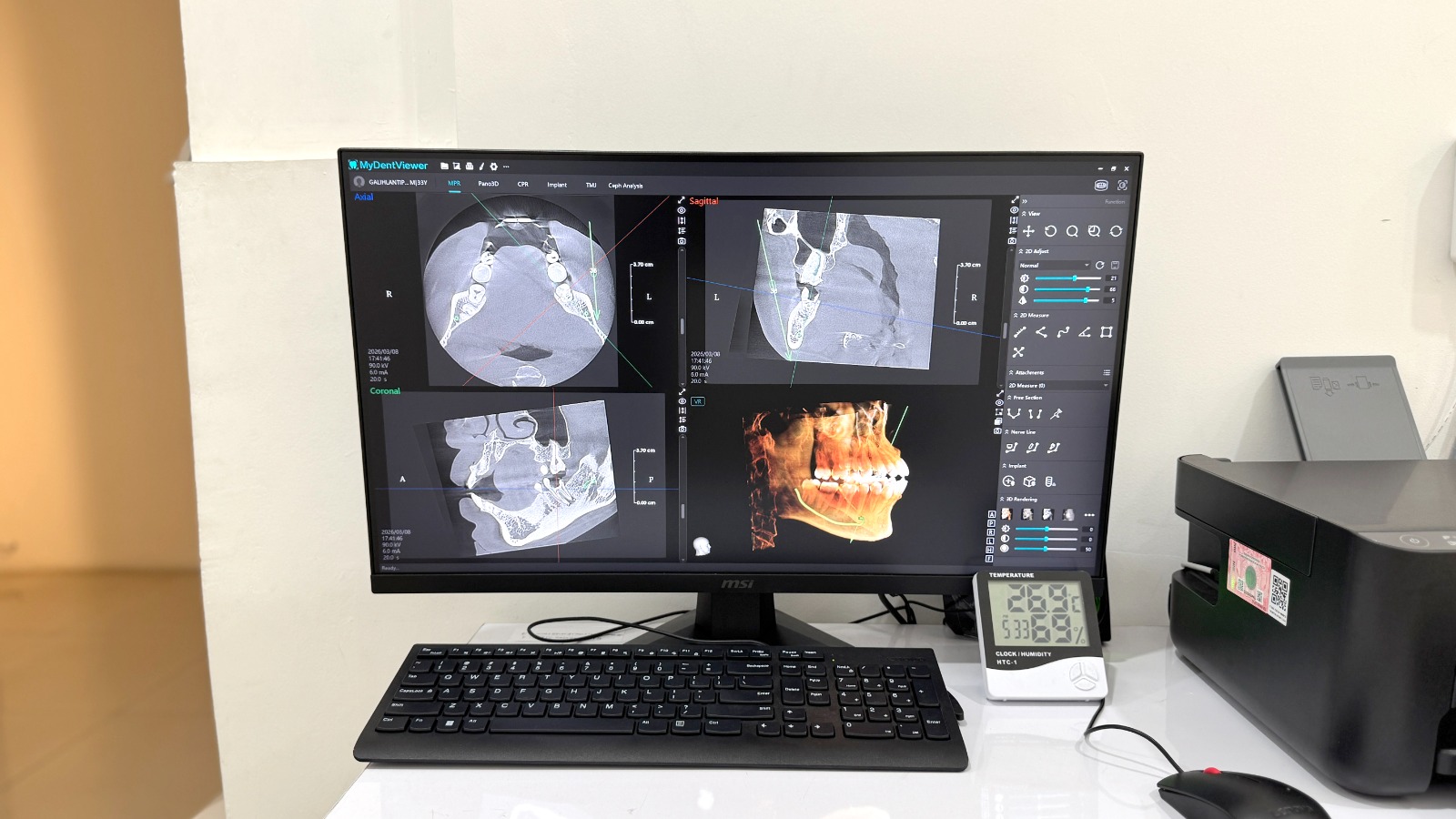 3D X-ray Technology Aids More Accurate Diagnosis of Dental and Jaw Issues