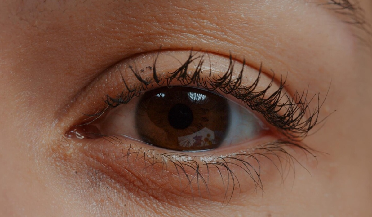 Understanding Thyroid Eye Disease: Symptoms of Bulging Eyes Due to Thyroid Disorders