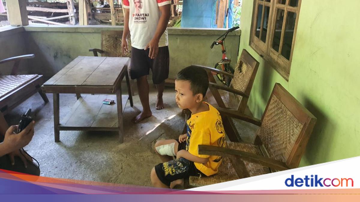 Escaped Pig-Tailed Macaque Attacks Three People in Gunungkidul