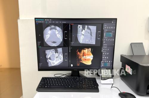 CBCT Technology Enables More Accurate Dental Diagnosis