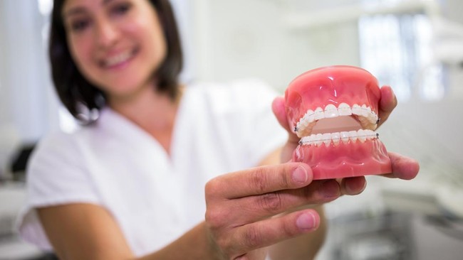 Requirements and Procedure for Dental Scaling Using BPJS Kesehatan