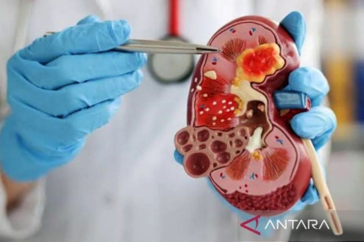 Dehydration and Hypertension Can Trigger Kidney Failure, Doctor Says