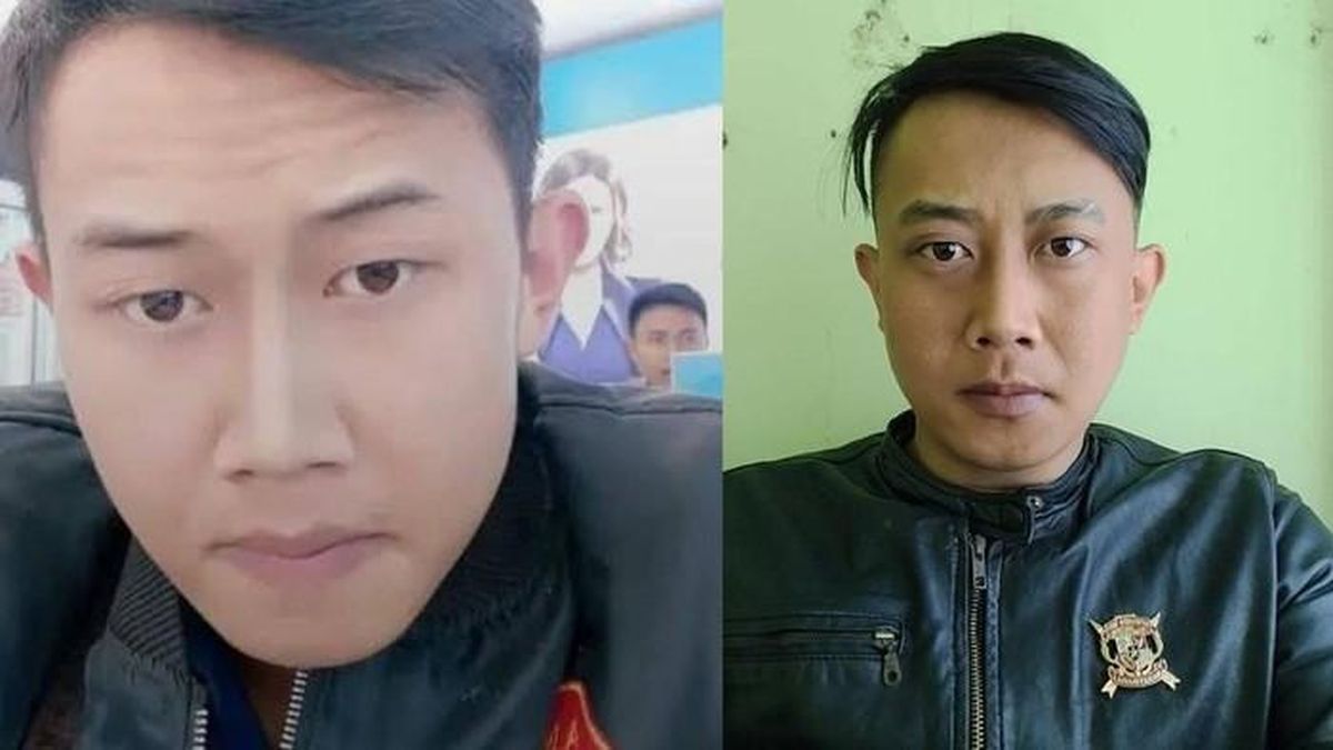 Taufik Hidayat's Victim YTR Had Serious Head Infection with Maggots