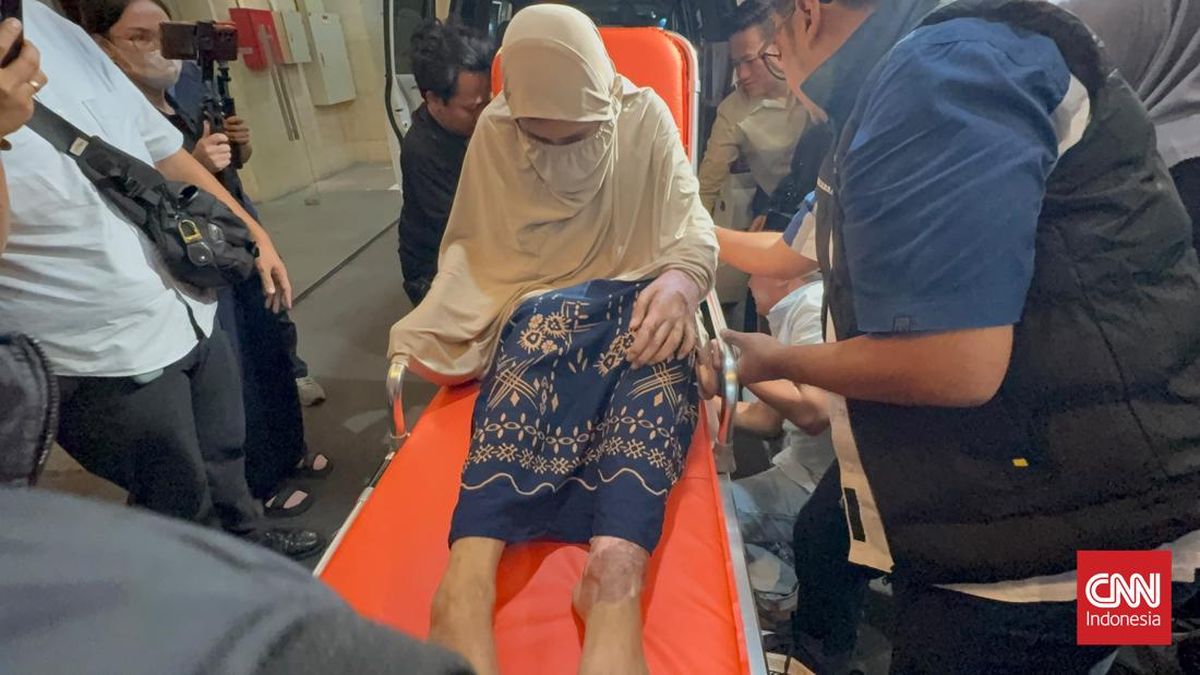 Woman in Central Java Allegedly Held Captive and Doused with Acid by Police Officer