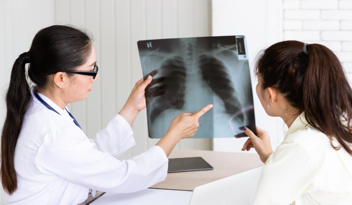 Challenges in Lung Cancer Treatment in Indonesia: From Screening to Access to Targeted Therapy