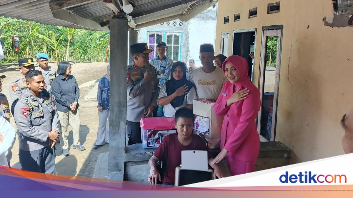 NTB Police Chief Invites Santri Burn Victim to Seek Treatment at Bhayangkara Hospital
