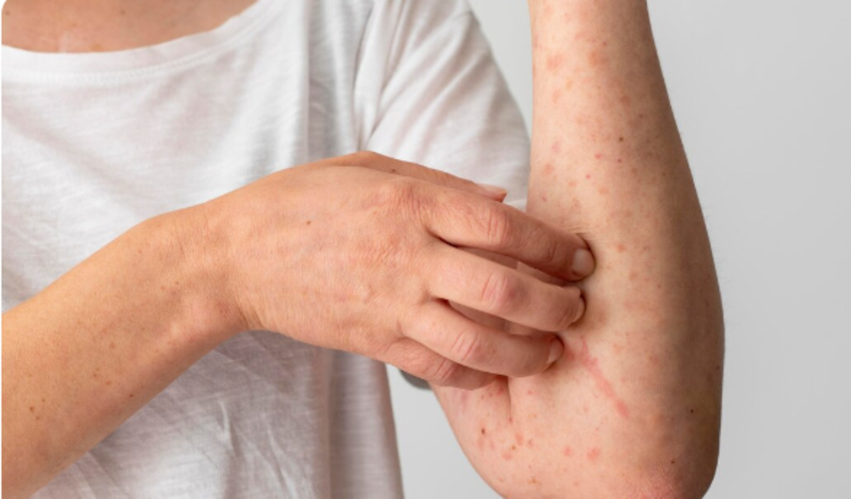 How Climate Change Affects Allergies and Respiratory Health: An Explanation